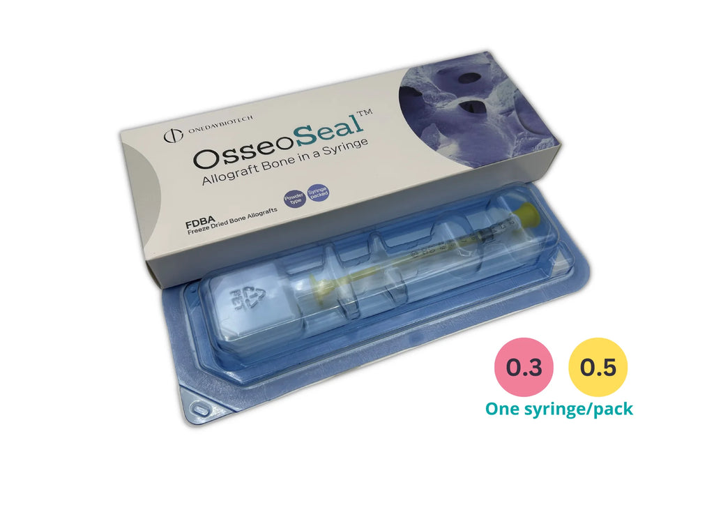 OsseoSeal Mineralized Allograft Prefilled Bone in Syringe