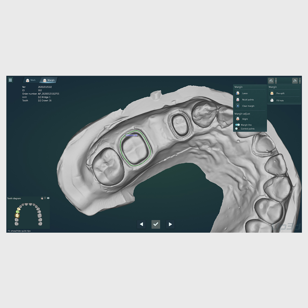 UP3D UPCAD - Dental CAD/CAM Solution